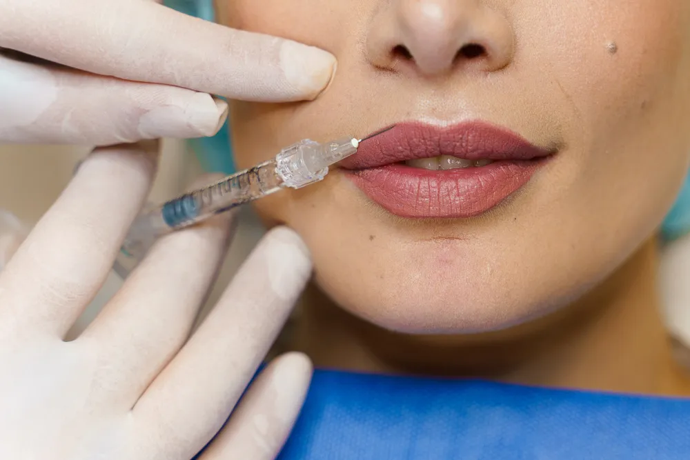 woman getting lip fillers in Livonia MI