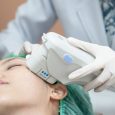 BBL SkinTyte laser treatment Canton MI