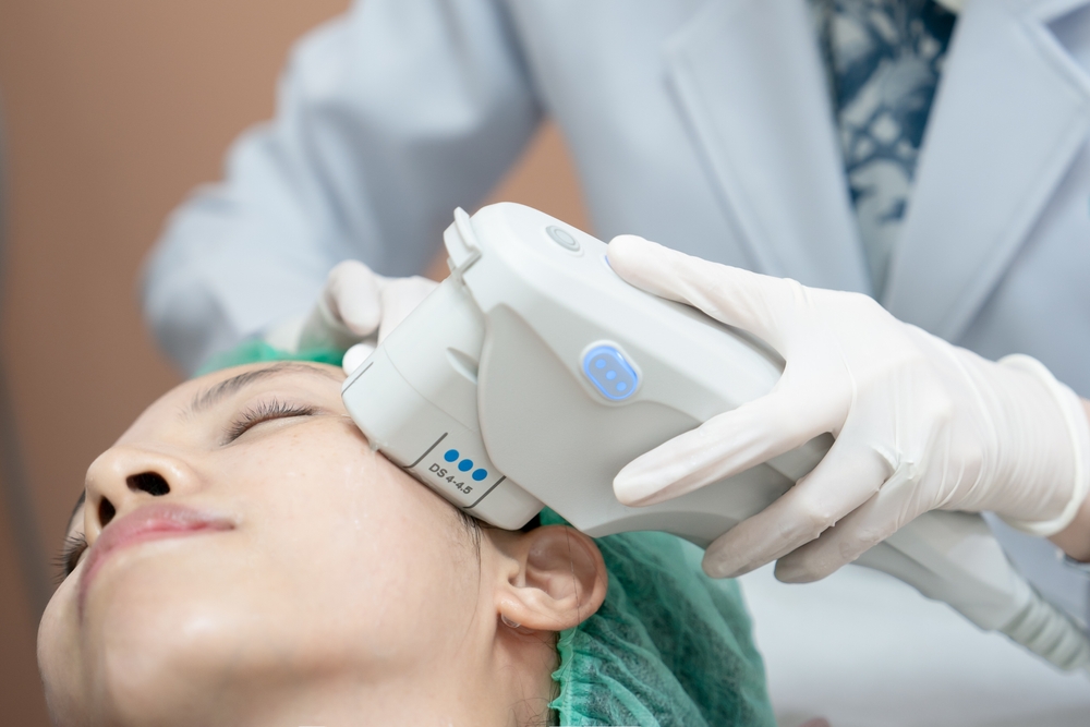 BBL SkinTyte laser treatment Canton MI